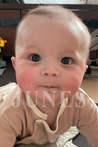 ルーカス　ストーン